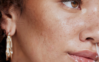 Radiant Lift Facial Contouring NYC