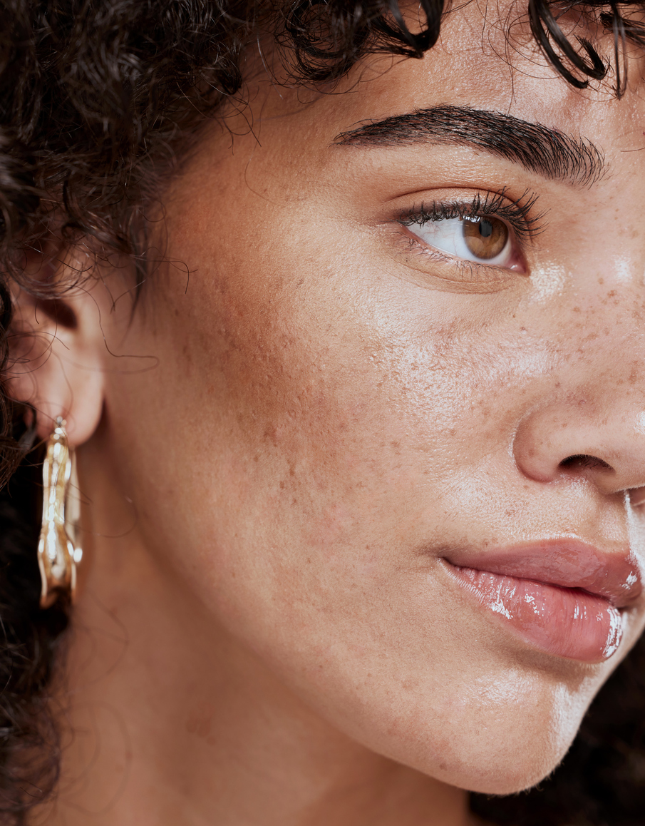 Radiant Lift Facial Contouring NYC Radiant Lift Facial Contouring NYC