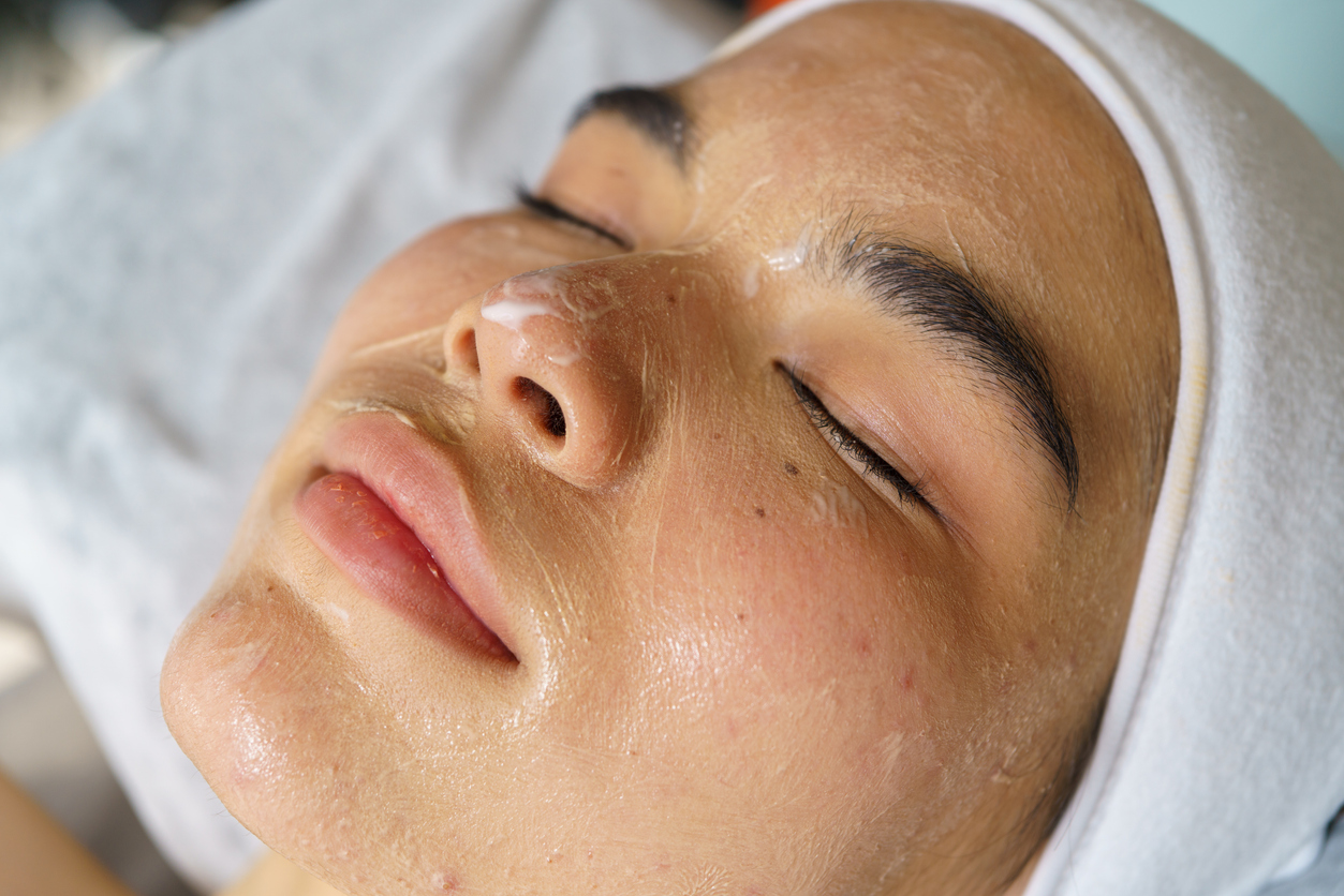 deep facial peel near me nyc reforma deep facial peel near me nyc reforma